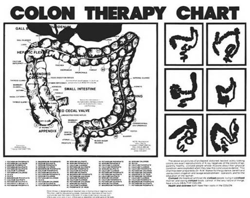 Colon Therapy Chart